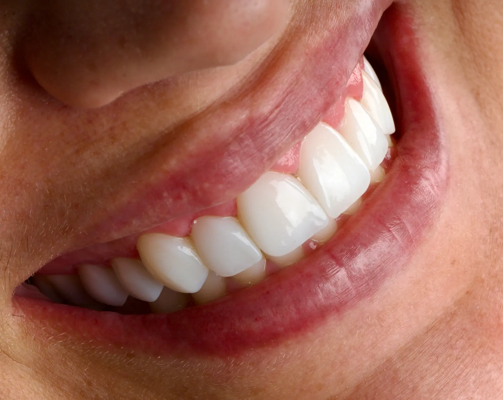 Detalhe de um sorriso em ângulo lateral, com a textura e o brilho de dentes naturais